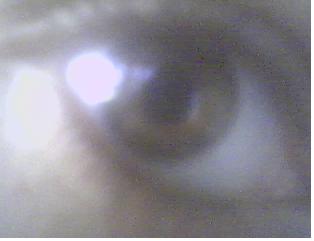 mon oeil